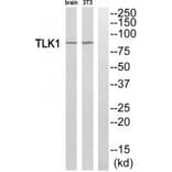 Western blot - TLK1 Antibody from Signalway Antibody (35297) - Antibodies.com