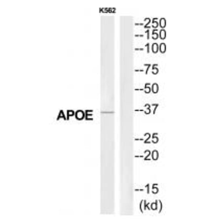 Western blot - APOE Antibody from Signalway Antibody (35301) - Antibodies.com