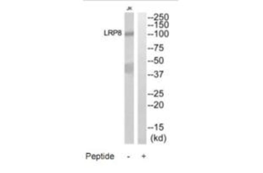 Western blot - LRP8 Antibody from Signalway Antibody (35302) - Antibodies.com