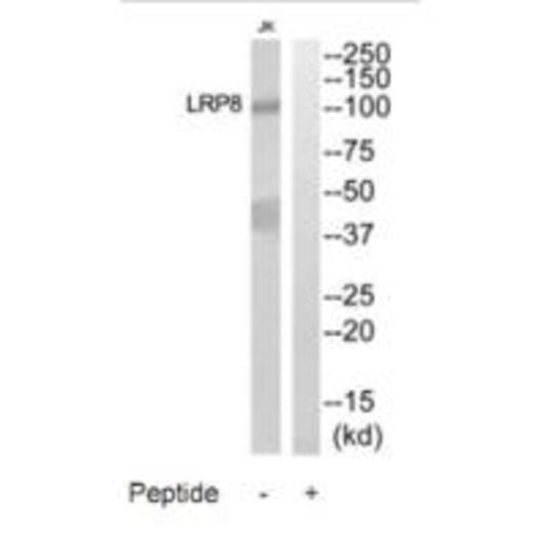 Western blot - LRP8 Antibody from Signalway Antibody (35302) - Antibodies.com