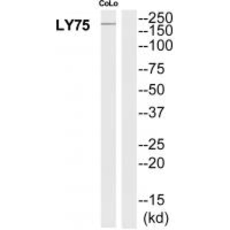 Western blot - LY75 Antibody from Signalway Antibody (35311) - Antibodies.com