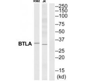 Western blot - BTLA Antibody from Signalway Antibody (35313) - Antibodies.com