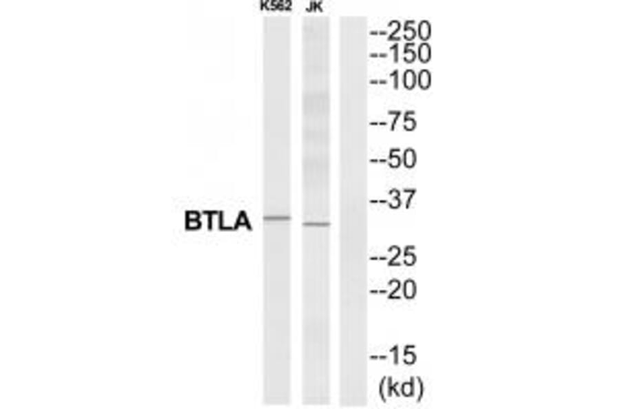 Western blot - BTLA Antibody from Signalway Antibody (35313) - Antibodies.com