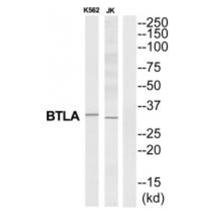 Western blot - BTLA Antibody from Signalway Antibody (35313) - Antibodies.com