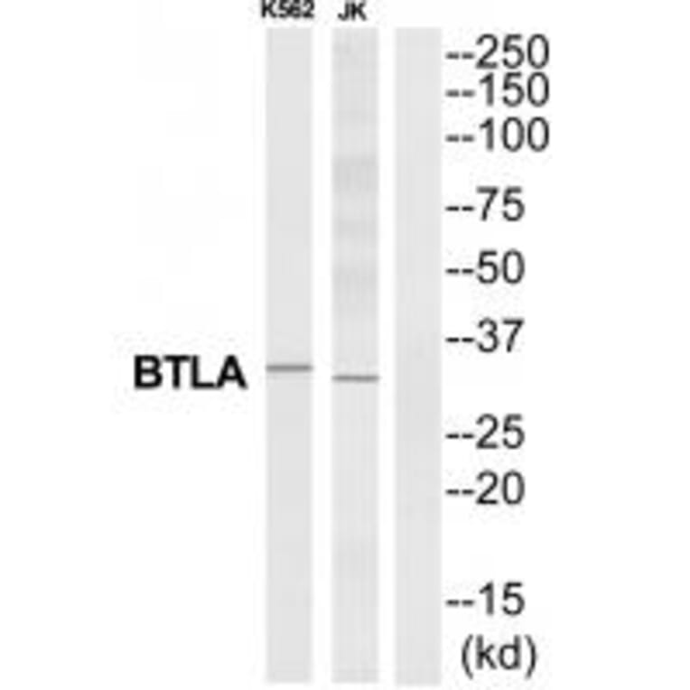 Western blot - BTLA Antibody from Signalway Antibody (35313) - Antibodies.com