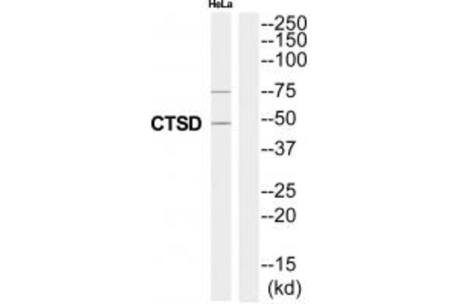 Western blot - CTSD Antibody from Signalway Antibody (35320) - Antibodies.com