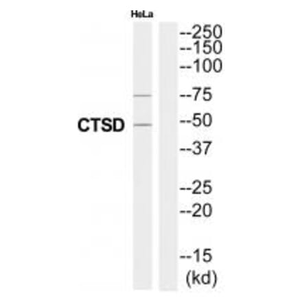 Western blot - CTSD Antibody from Signalway Antibody (35320) - Antibodies.com