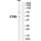 Western blot - CTSD Antibody from Signalway Antibody (35320) - Antibodies.com