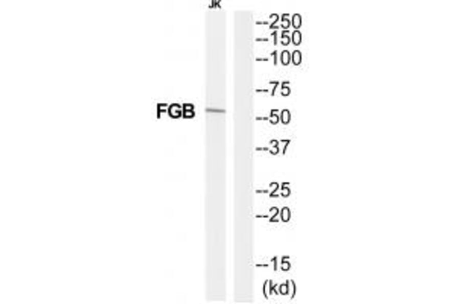 Western blot - FIBB Antibody from Signalway Antibody (35322) - Antibodies.com