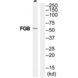 Western blot - FIBB Antibody from Signalway Antibody (35322) - Antibodies.com