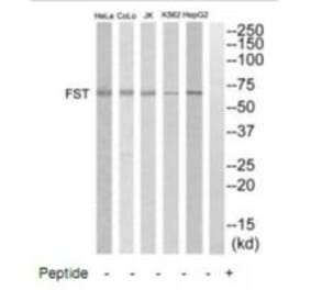 Western blot - FST Antibody from Signalway Antibody (35331) - Antibodies.com