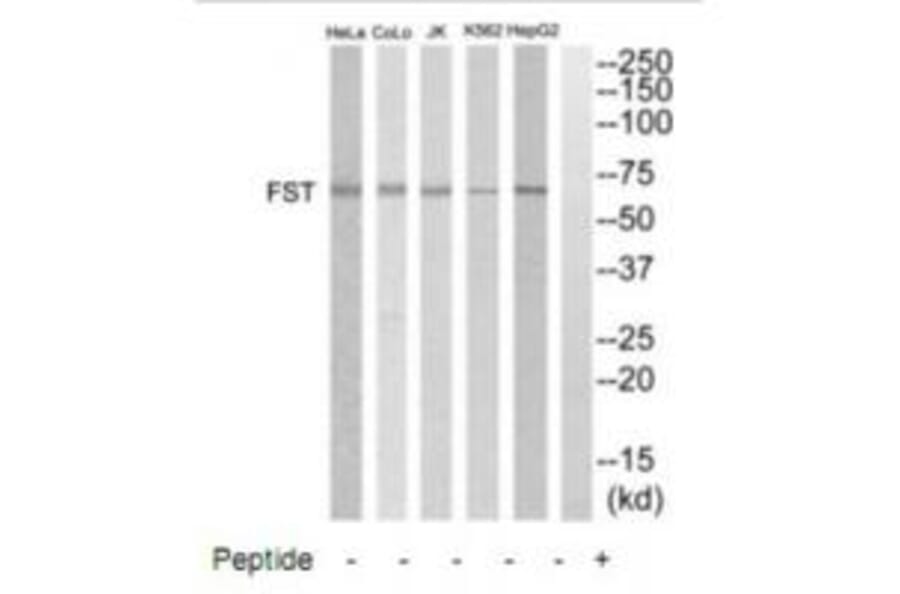 Western blot - FST Antibody from Signalway Antibody (35331) - Antibodies.com