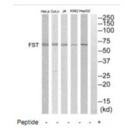 Western blot - FST Antibody from Signalway Antibody (35331) - Antibodies.com