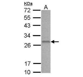 BCL2 Antibody from Signalway Antibody (35342) - Antibodies.com