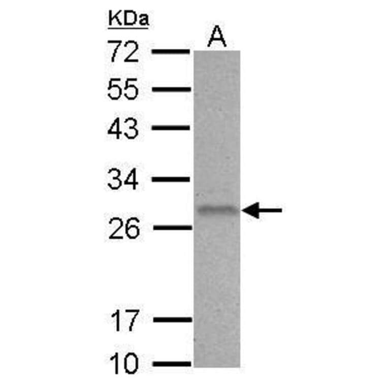 BCL2 Antibody from Signalway Antibody (35342) - Antibodies.com