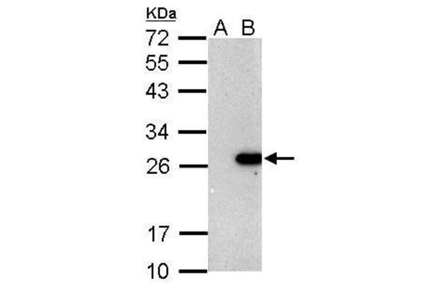 BCL2 Antibody from Signalway Antibody (35342) - Antibodies.com