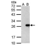 BCL2 Antibody from Signalway Antibody (35342) - Antibodies.com