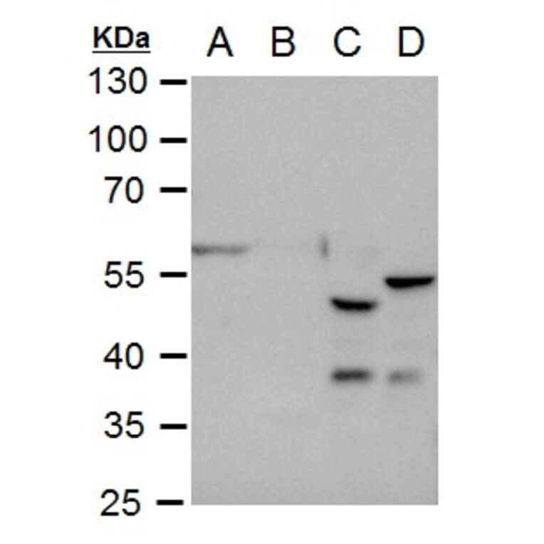 GFAP Antibody from Signalway Antibody (35350) - Antibodies.com