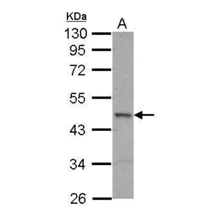 ELK1 Antibody from Signalway Antibody (35362) - Antibodies.com