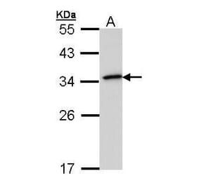 NQO1 Antibody from Signalway Antibody (35365) - Antibodies.com