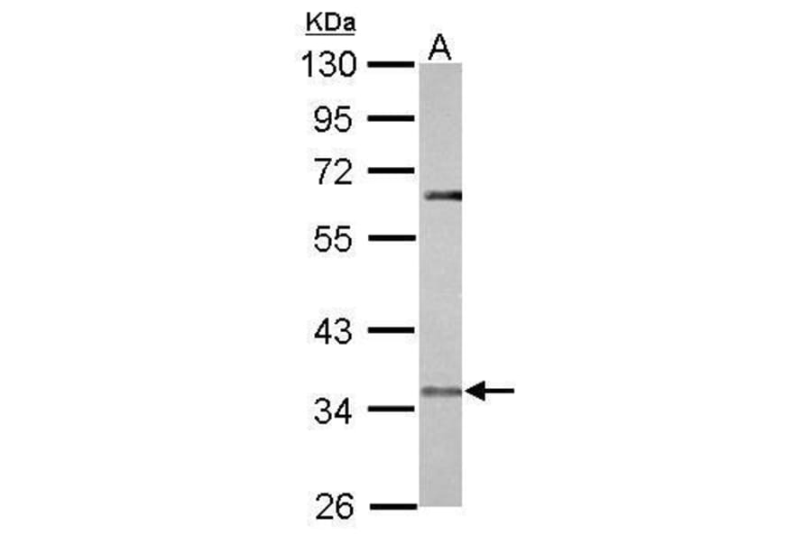 CCR5 Antibody from Signalway Antibody (35367) - Antibodies.com