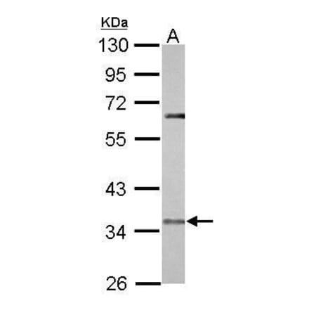 CCR5 Antibody from Signalway Antibody (35367) - Antibodies.com
