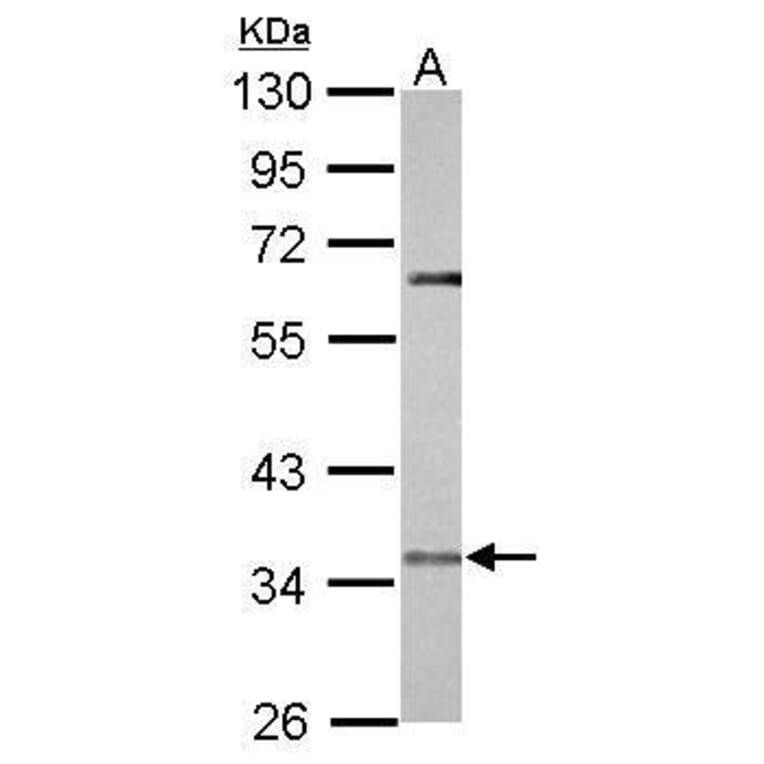 CCR5 Antibody from Signalway Antibody (35367) - Antibodies.com