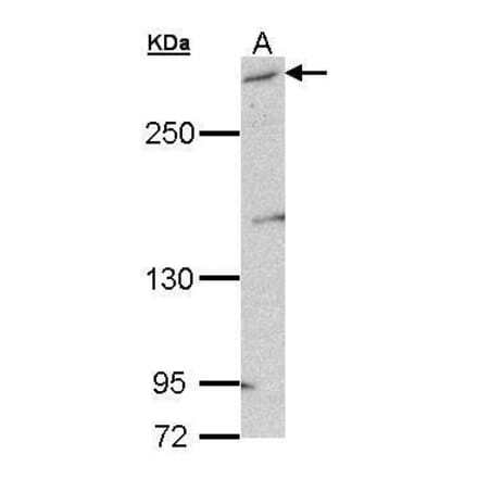mTOR Antibody from Signalway Antibody (35373) - Antibodies.com