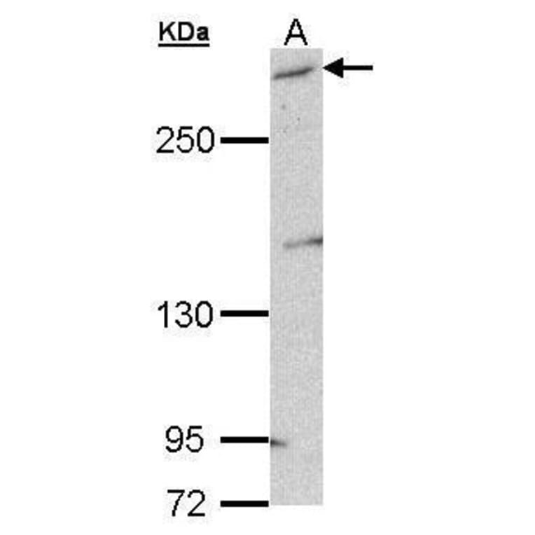 mTOR Antibody from Signalway Antibody (35373) - Antibodies.com