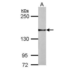 NCAM Antibody from Signalway Antibody (35377) - Antibodies.com