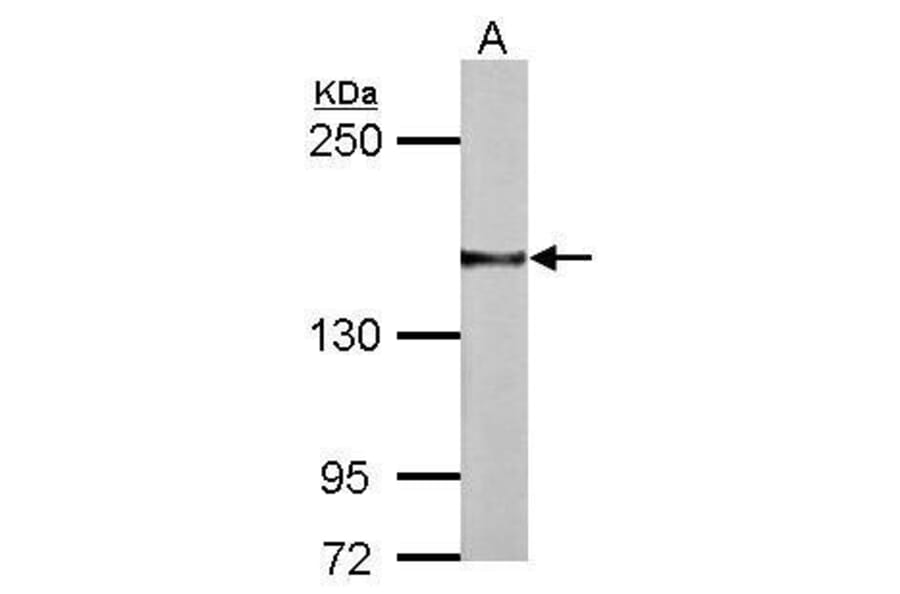 NCAM Antibody from Signalway Antibody (35377) - Antibodies.com