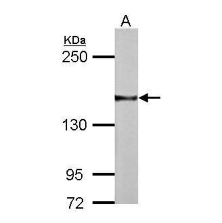 NCAM Antibody from Signalway Antibody (35377) - Antibodies.com