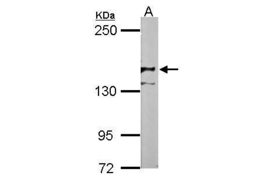 NCAM Antibody from Signalway Antibody (35377) - Antibodies.com