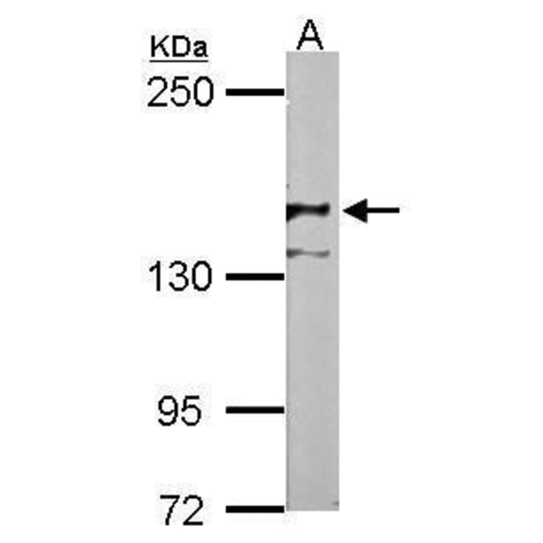 NCAM Antibody from Signalway Antibody (35377) - Antibodies.com