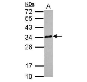 CLTA Antibody from Signalway Antibody (35385) - Antibodies.com
