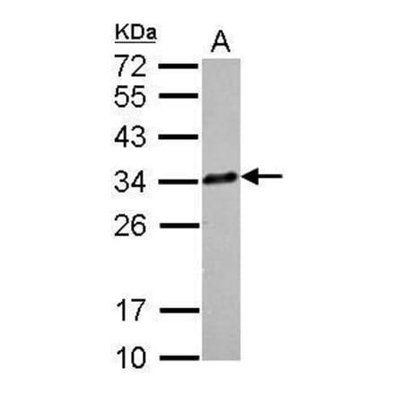 CLTA Antibody from Signalway Antibody (35385) - Antibodies.com