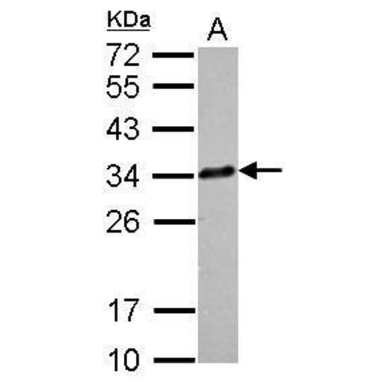 CLTA Antibody from Signalway Antibody (35385) - Antibodies.com