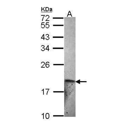 ET-2 Antibody from Signalway Antibody (35400) - Antibodies.com