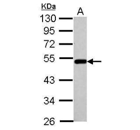 BLMH Antibody from Signalway Antibody (35402) - Antibodies.com