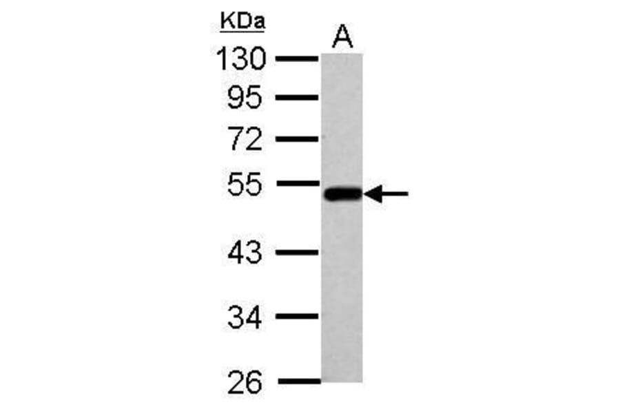 BLMH Antibody from Signalway Antibody (35402) - Antibodies.com