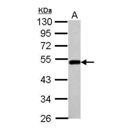 BLMH Antibody from Signalway Antibody (35402) - Antibodies.com