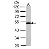 BLMH Antibody from Signalway Antibody (35402) - Antibodies.com