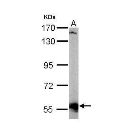 AKT3 Antibody from Signalway Antibody (35422) - Antibodies.com