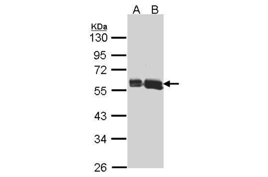 AKT3 Antibody from Signalway Antibody (35422) - Antibodies.com