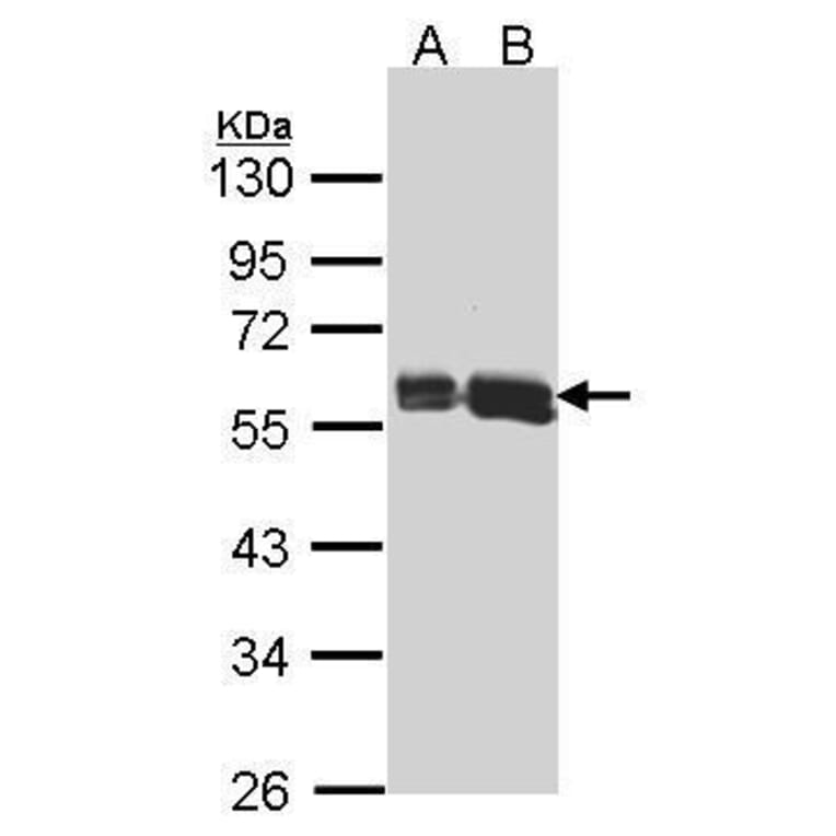 AKT3 Antibody from Signalway Antibody (35422) - Antibodies.com