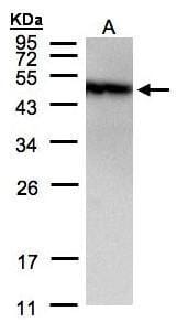 Sample (30 &#956;g of whole cell lysate)A431 12% SDS PAGE#35435 diluted at 1: 1500