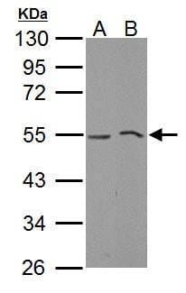Sample (30 µg of whole cell lysate)?  THP-1 B: ? NCI-H929 10% SDS PAGE? #35441 diluted at 1: 1000 ?