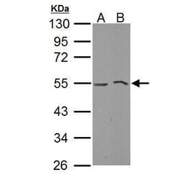 MLKL Antibody from Signalway Antibody (35441) - Antibodies.com