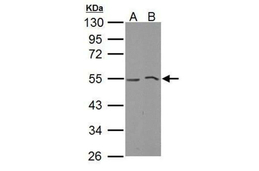 MLKL Antibody from Signalway Antibody (35441) - Antibodies.com