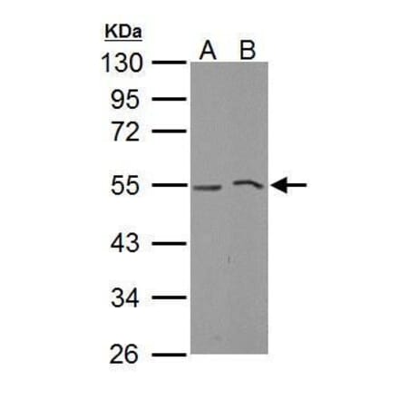 MLKL Antibody from Signalway Antibody (35441) - Antibodies.com